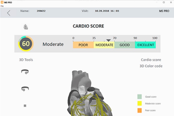 Cardio Score on Tablet